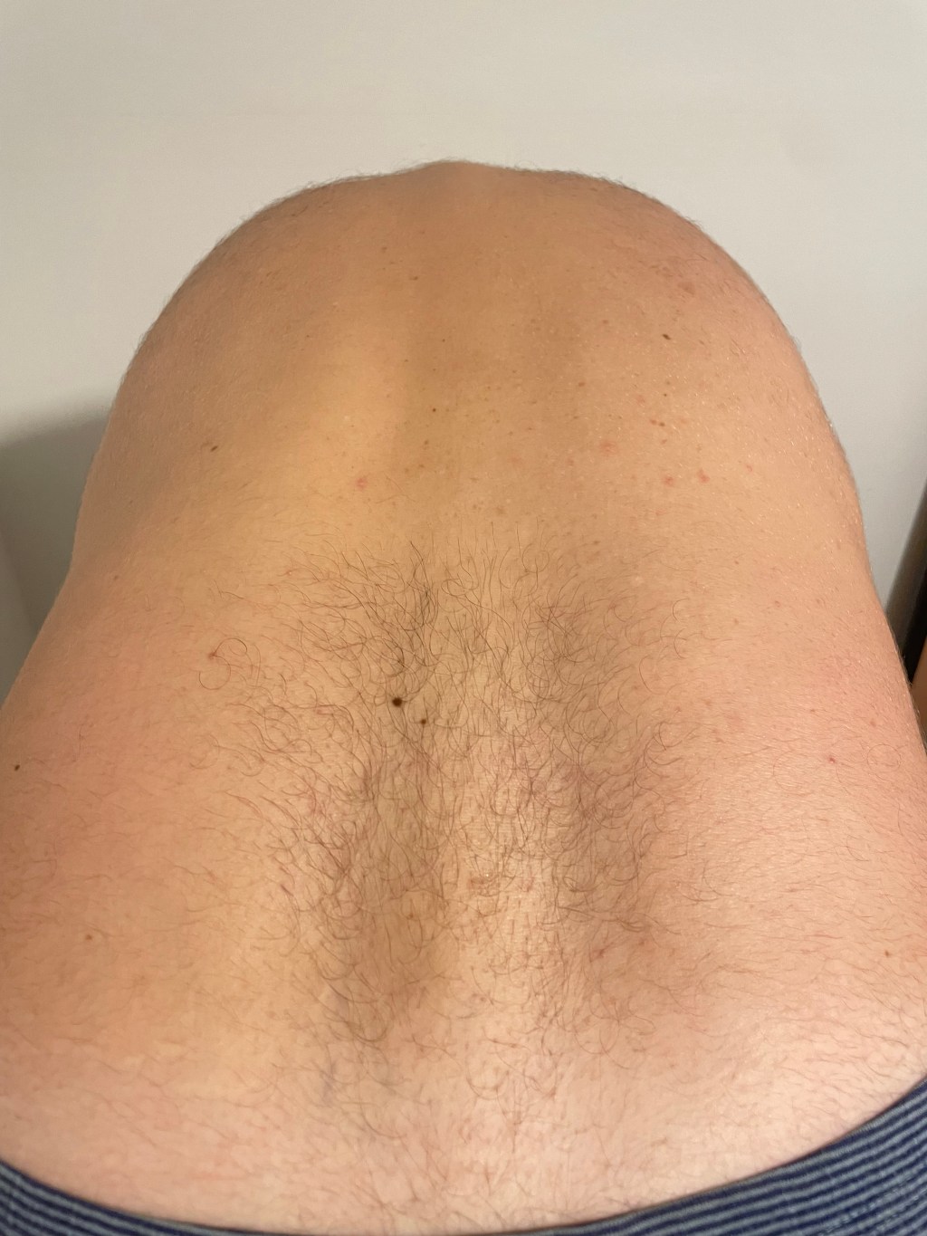 dolor sacroilíaco, dolor pélvico