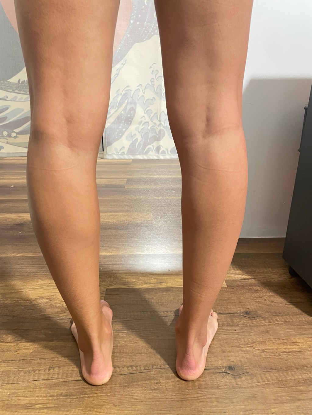 Ondas de choque Tendinitis Aquiles